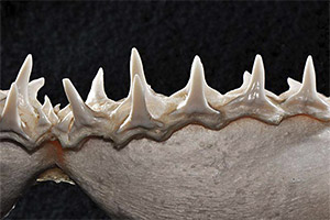 die untere Gebisshälfte