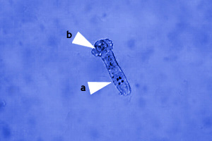 Dactylogyrus