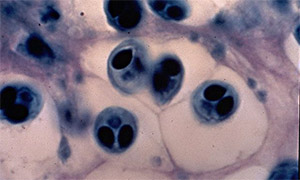 Gewebe einer Forelle mit Läsionen und sich entwickelnden Sporen