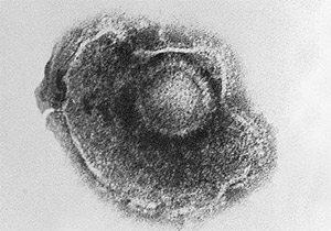 Varizella-Zoster-Virus im TEM