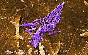 Mycobacterium fortuitum