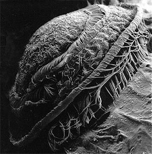 Trichodina - Autor:A.D.M. Dove - Lizenz:Namensnennung des Urhebers