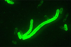 Yersinia pestis im Fluoreszenz-Mikroskop mit Fluoreszenz-markiertem Antikörper gegen ein Kapsel-Antigen